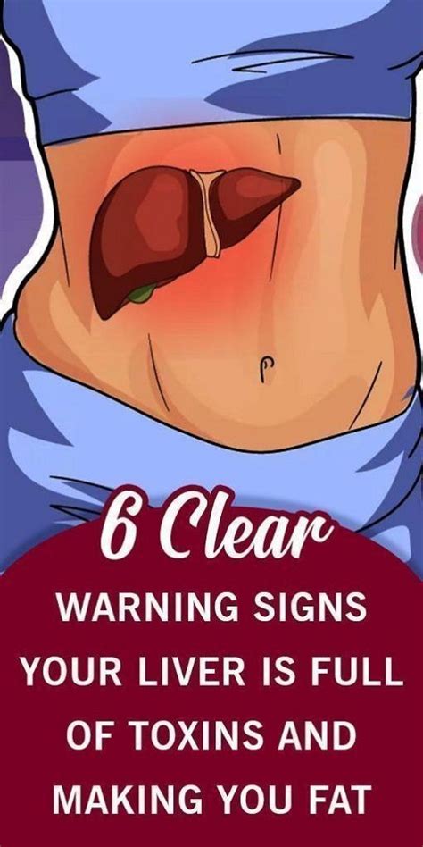 6 Clear Warning Signs Your Liver Is Full Of Toxins And Making You Fat How To Stop It Liver