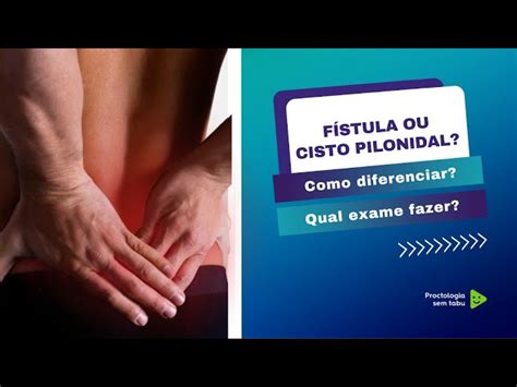 Pq O Cisto Pilonidal Fura O Reto - Ressonancia Magnetica De Cisto Pilonidal Cisto Pilonidal: Como é
