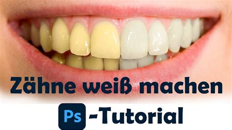 Z Hne Wei Machen Bzw Aufhellen Photoshop Tutorial Deutsch Youtube