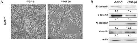 A MCF 7 cells treated with 10 ng ml TGF β1 for 24 hrs had a