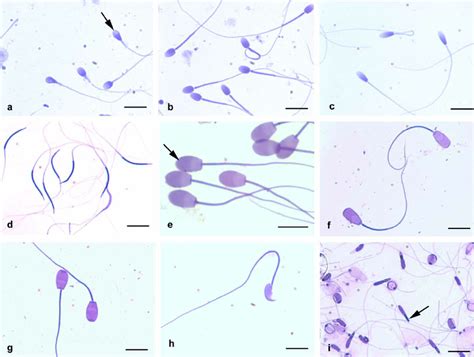 Sperm Cell Slide