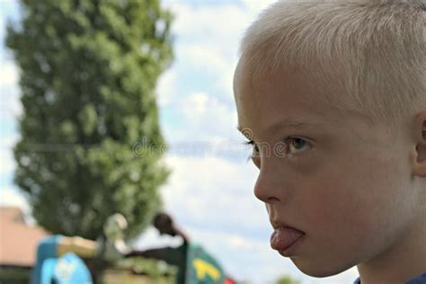 Boy with a Down Syndrome Who is Playing in a Park. Stock Photo - Image of looks, playing: 121004348