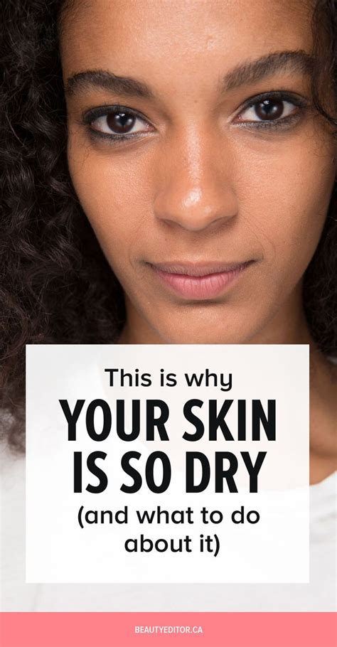 This Is Why Your Skin Is So Dry Even When You Moisturize And What You