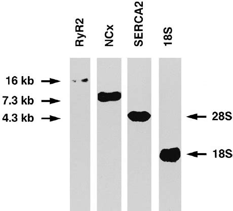 Autoradiographs Of Northern Hybridization Analysis Of 20 M G Of Total