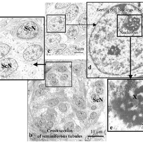 Transmission Electron Micrographs Showing The Sertoli Cells At 1 Month