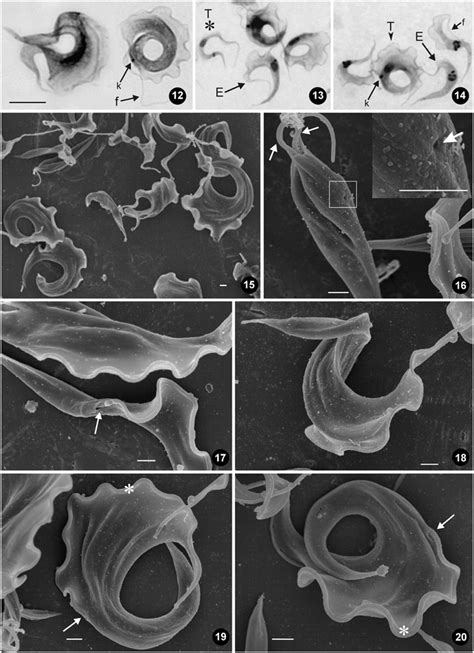 20. Light (12–14) and field emission scanning electron microscopy... | Download Scientific Diagram