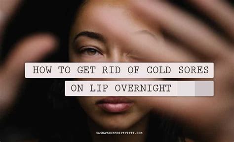 How To Get Rid Of Cold Sores On Lip Printable Templates