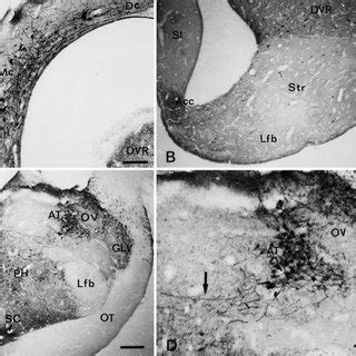 A D Photomicrographs Of Transverse Sections Through The Telencephalon