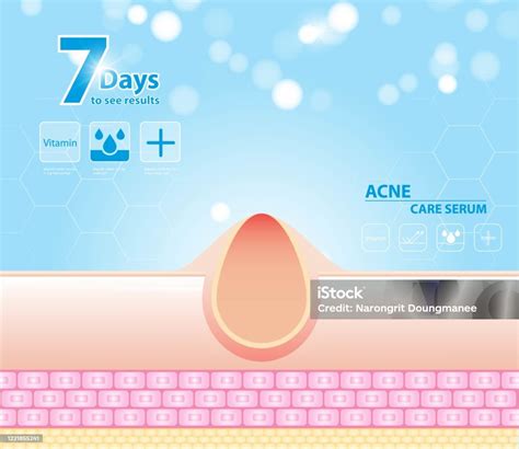 Three Main Layer Of The Human Skin Skin Aging Stages Diagrams Ollagen