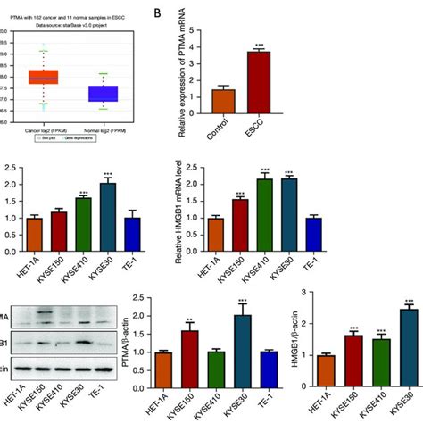 The Expression Of Ptma In Escc Is Significantly Elevated A The