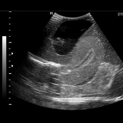 Isuog Practice Guidelines Updated Performance Of Off