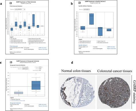 Clinical Relevance Of GABRP In CRC Patients A GABRP Overexpressed