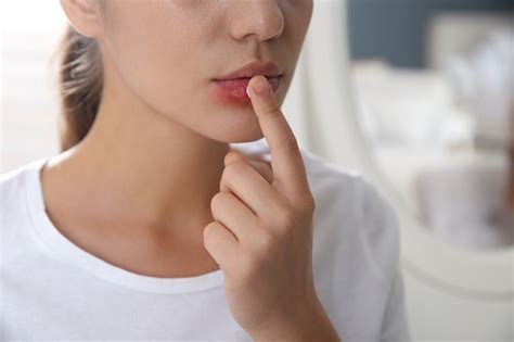 Herpes Di Bibir Dan Mulut Kenali Gejala Dan Cara Mengatasinya Alodokter