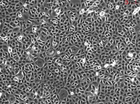 Human Small Airway Epithelial Cells Adult HPSAEpiC A