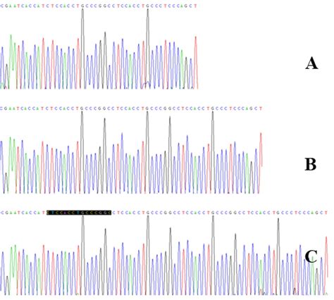 Association Analysis Of TNFRSF1B Polymorphism With Susceptibility For