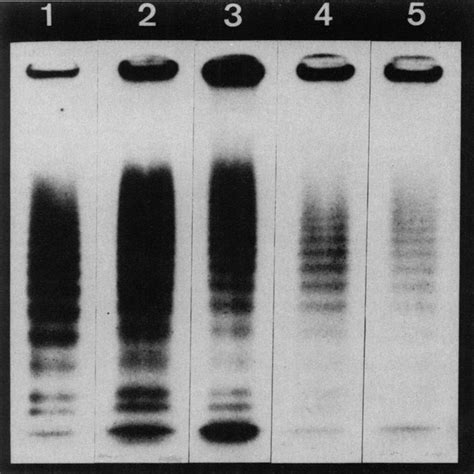 SDS Agarose Gel Electrophoresis Of Free And Bound I VWF Lane 1 Free