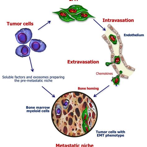 Incidence Of Bone Metastases In Cancer Download Scientific Diagram