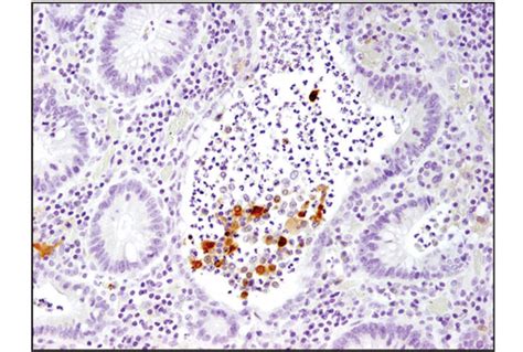 Il 1β 3a6 Mouse Mab Cell Signaling Technology