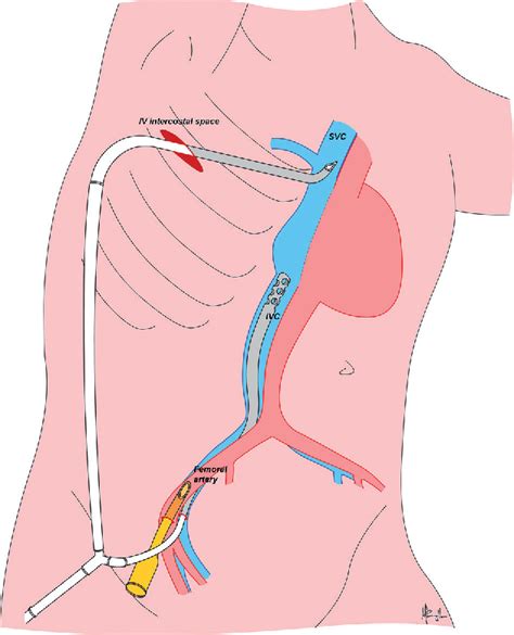 Figure 2 From Minimally Invasive Approach In Surgery For Congenital