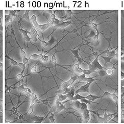 The Appearance Of The Differentiated SH SY5Y Cells Treated With 100 Or