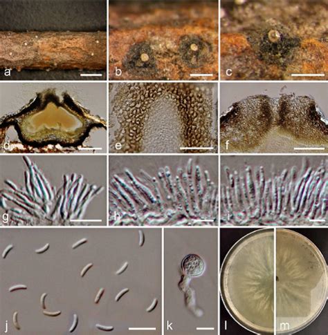 Cytospora Curvata Facesoffungi Number FoF 02737 Faces Of Fungi