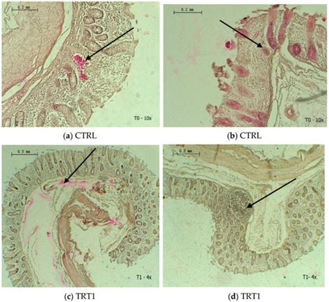 Ileocecal Junction Histology