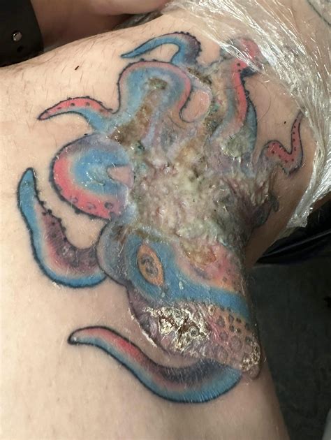 Tattoo done by another local artist that got infected. Wondering if you