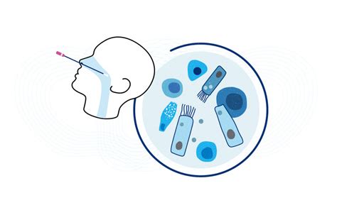 Early COVID-19 responses in the nose and throat predict disease ...