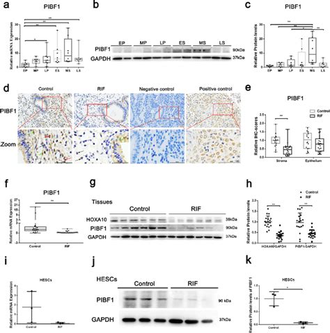 Expression Of Pibf And Hoxa In Endometrial Tissues And Hescs The