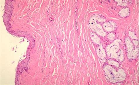 Medium Power Micrograph Of Esophagus Collection Of Histology Images