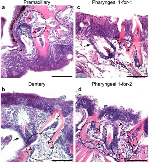 Oral And Pharyngeal Tooth Replacement Histology In Stickleback In All