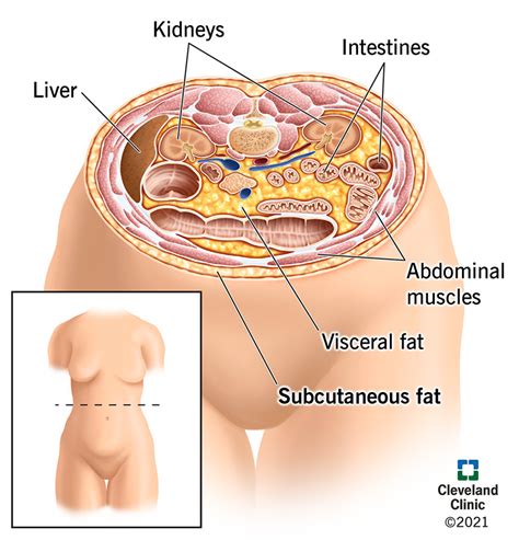 Subcutaneous Fat: What You Need to Know About the Fat Beneath Your Skin