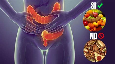 Alimentos para la colitis y la dieta más recomendada