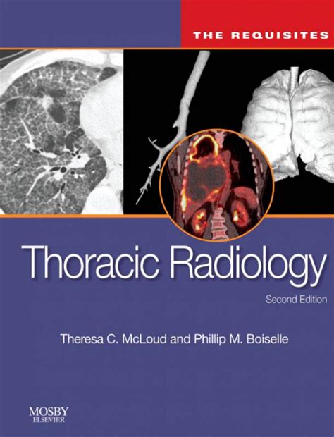 Thoracic Radiology The Requisites Second Edition – Digital Instant ...