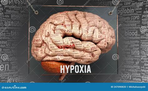 Hypoxia in human brain stock illustration. Illustration of mind - 247090820