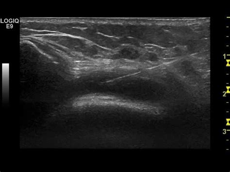 The Ultrasound Site Msk Ultrasound Education On Twitter Recently On