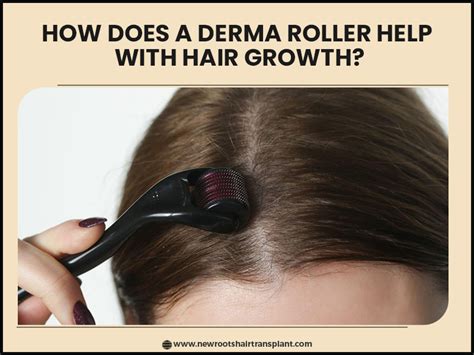 8 Benefits Of Using Derma Roller For Hair Growth Must Try 2023