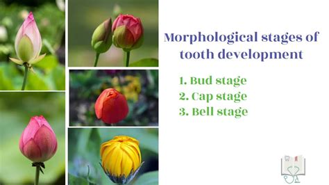 Development Of Tooth Part 2 Morphological Stages Bud Stage Youtube