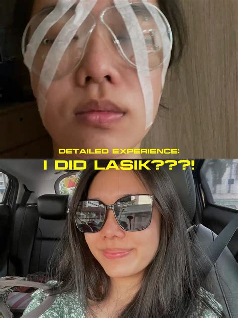 Must Read Before Doing Lasik 👁️ Gallery Posted By 🤍🍋 Lemon8