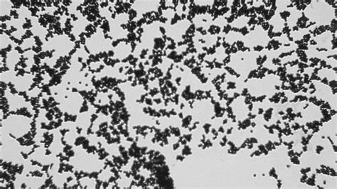 amy — gram positive and gram negative cells