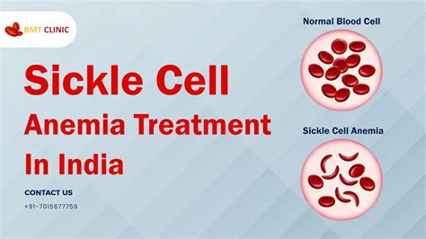 Sickle Cell Anemia Treatment Cost In India BMT Clinic