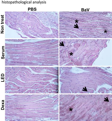 Histological Analysis Of Gastrocnemius Muscles After Isolated And