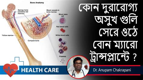 Bone Marrow Transplant বনমযর টরনসপলযনট Haematologists