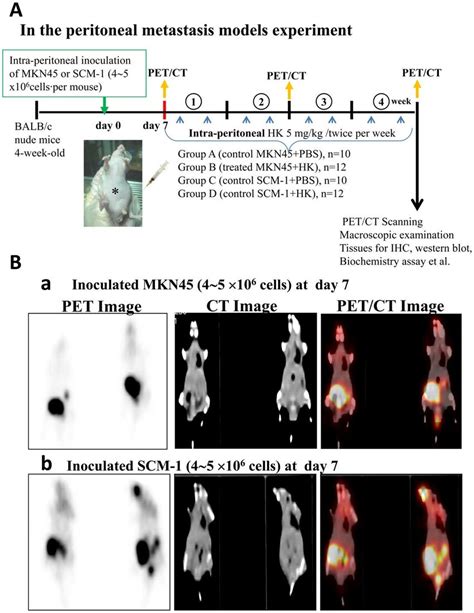 Schematic Representation Of Peritoneal Metastasis Mouse Model With Or