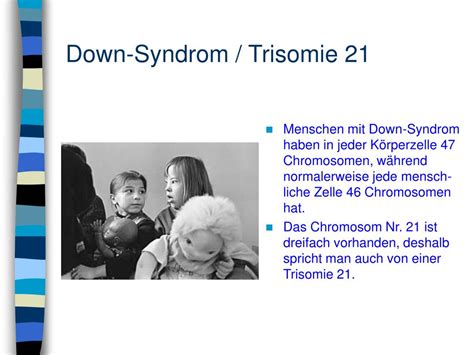 Ppt Down Syndrom Trisomie 21 Powerpoint Presentation Free Download