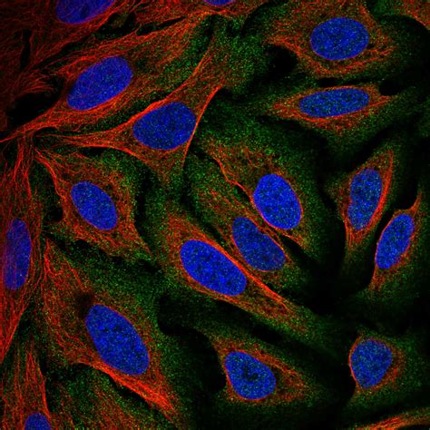 Subcellular Zdhhc The Human Protein Atlas