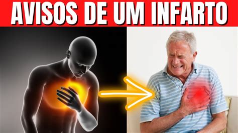 7 Sintomas Que Você Pode Ter Um Infarto A Qualquer Momento YouTube