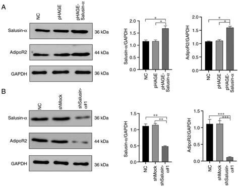 Overexpression of salusinα upregulates AdipoR2 and activates the PPARα