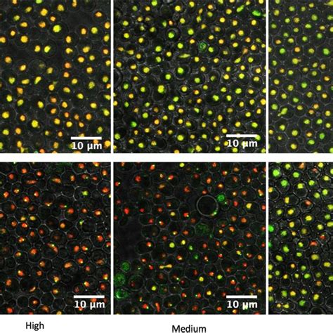 Fluorescence Microscopy Of Gfp Nab3 Green Granule Formation In Three