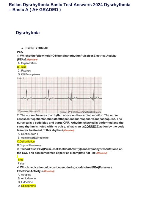 Solution Relias Dysrhythmia Basic Test Answers Dysrhythmia